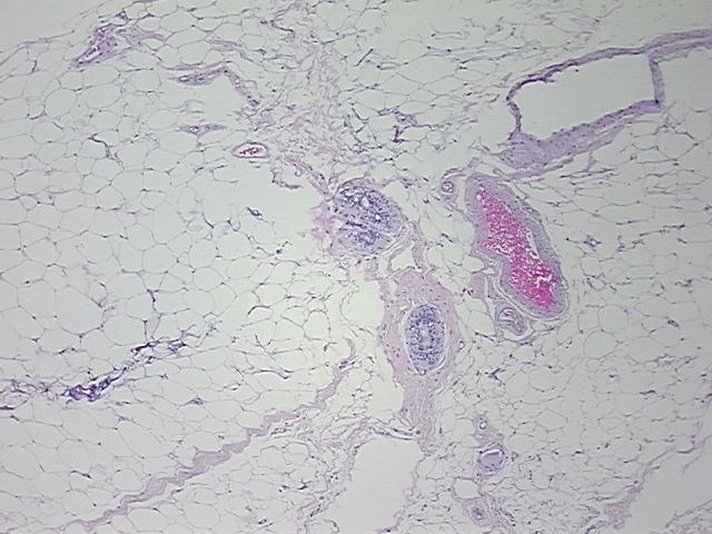 4x Image