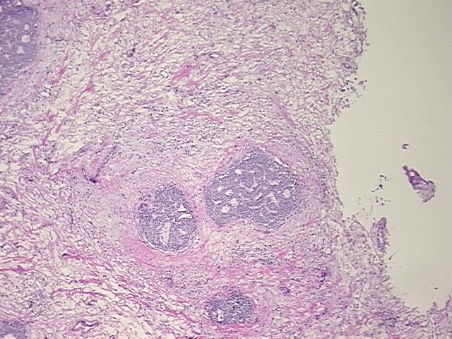 4x Image