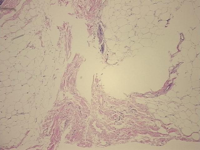 4x Image