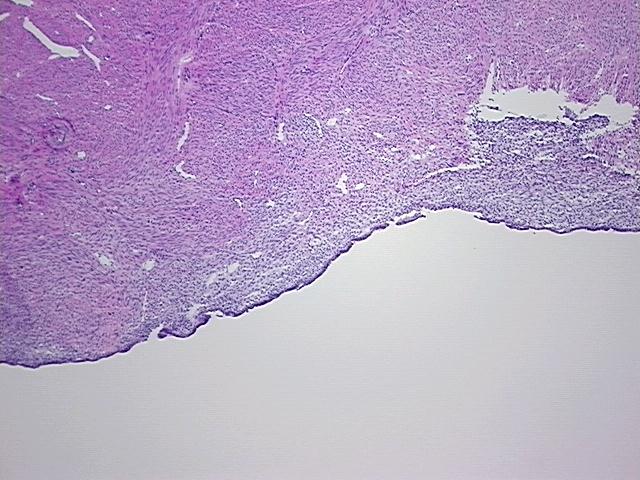 4x Image