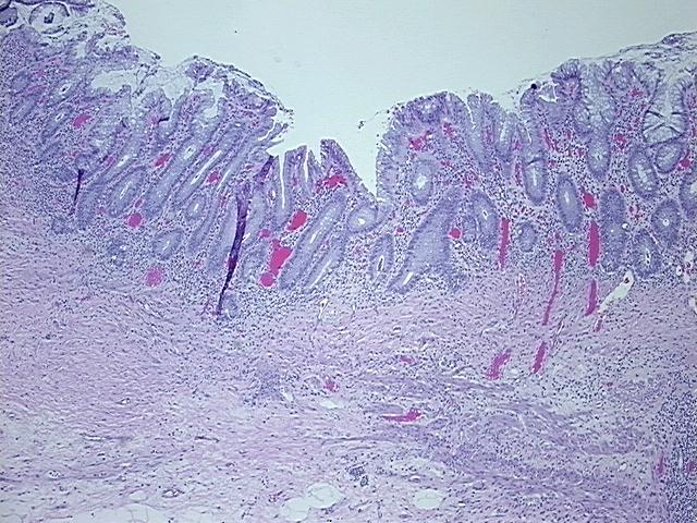 4x Image