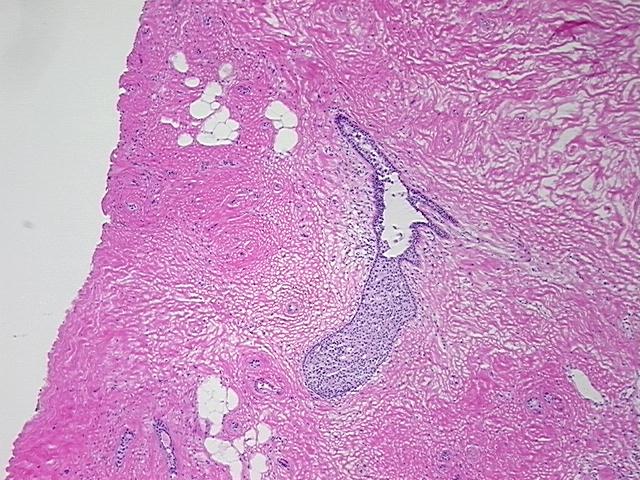4x Image