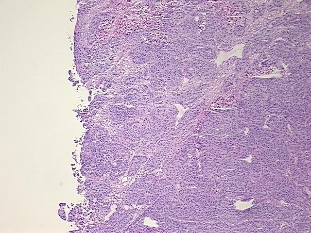 4x Image