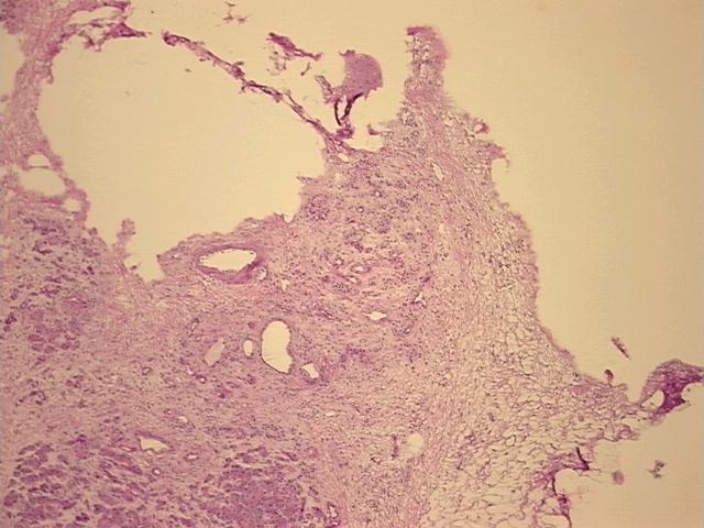 4x Image