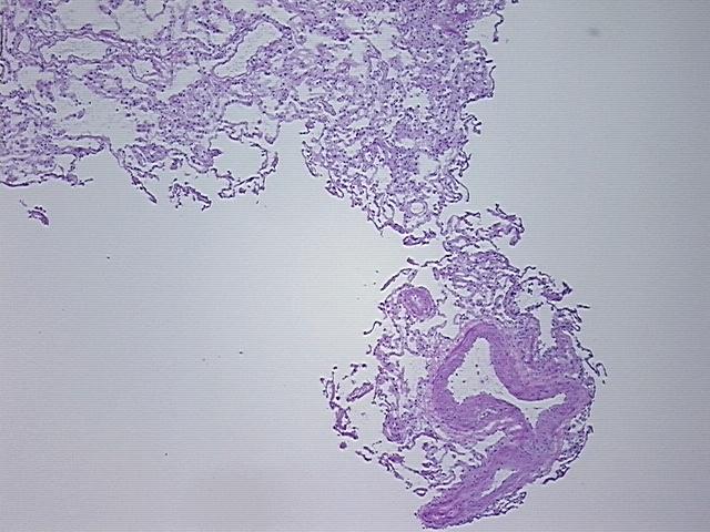 4x Image