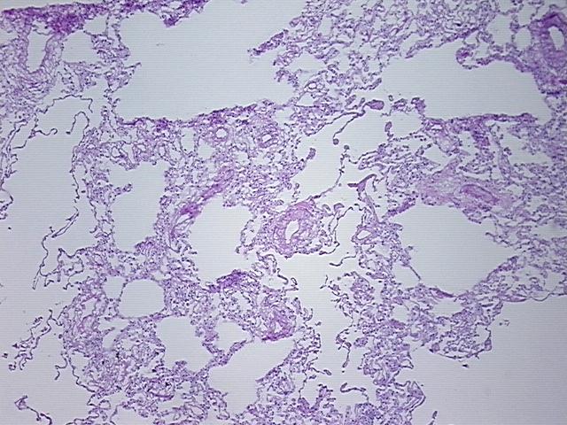 4x Image
