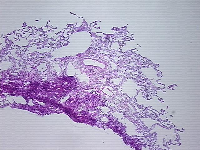 4x Image