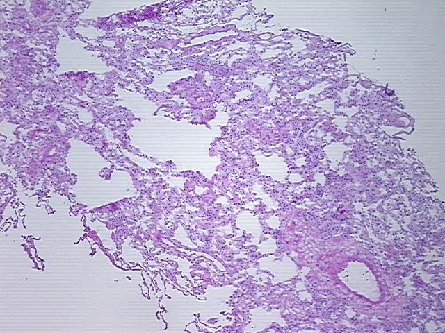 4x Image