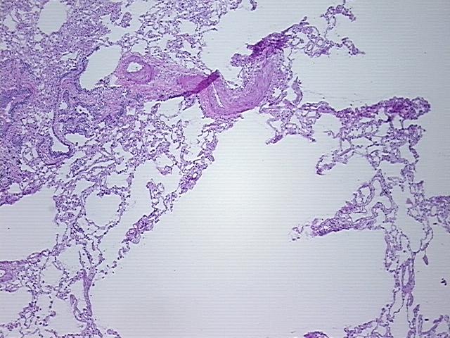 4x Image