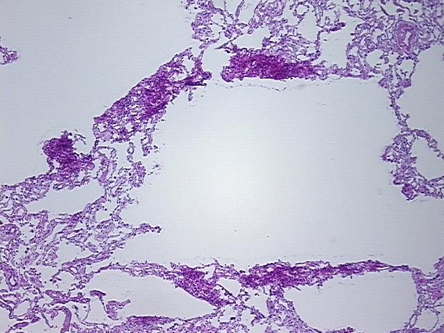4x Image