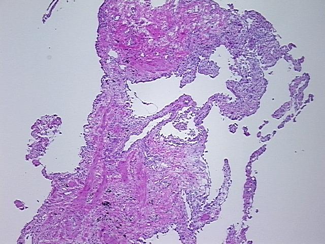 4x Image