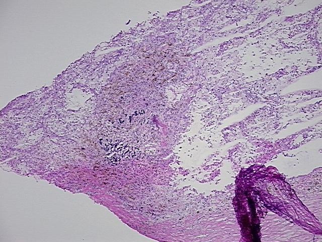 4x Image
