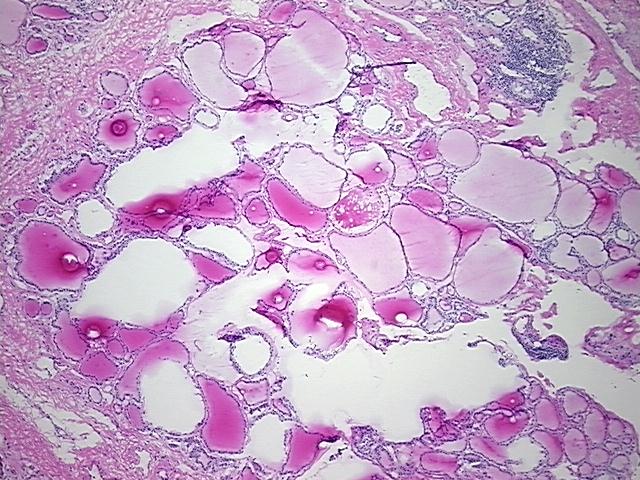 4x Image