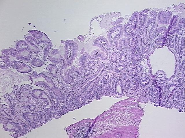 4x Image