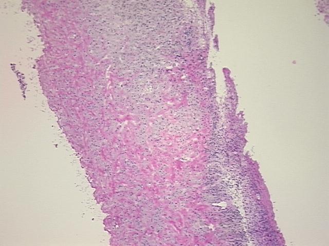 4x Image