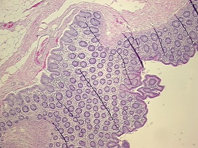 4x Image