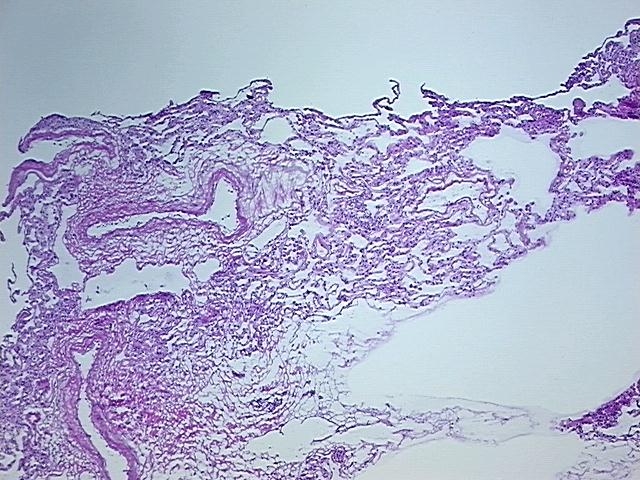 4x Image