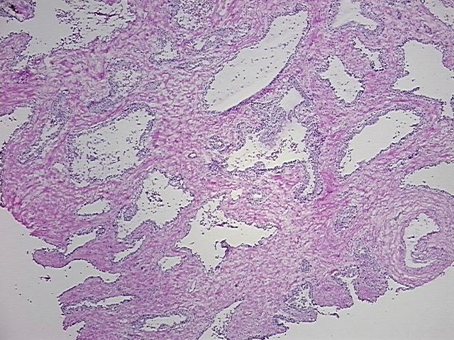 Frozen Tissue Sections, Prostate