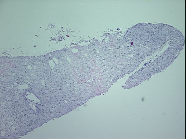 4x Image