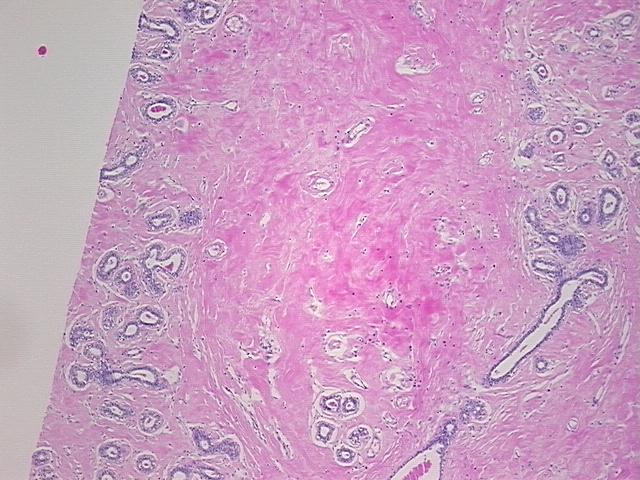 4x Image