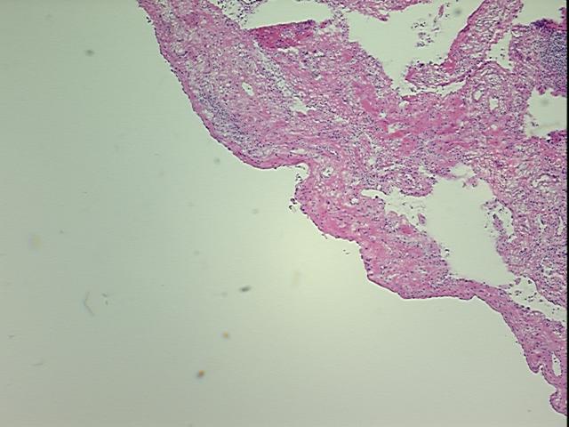 4x Image