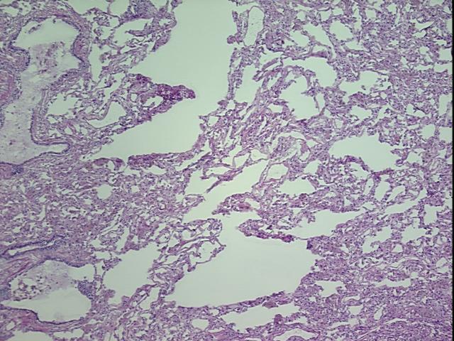 4x Image