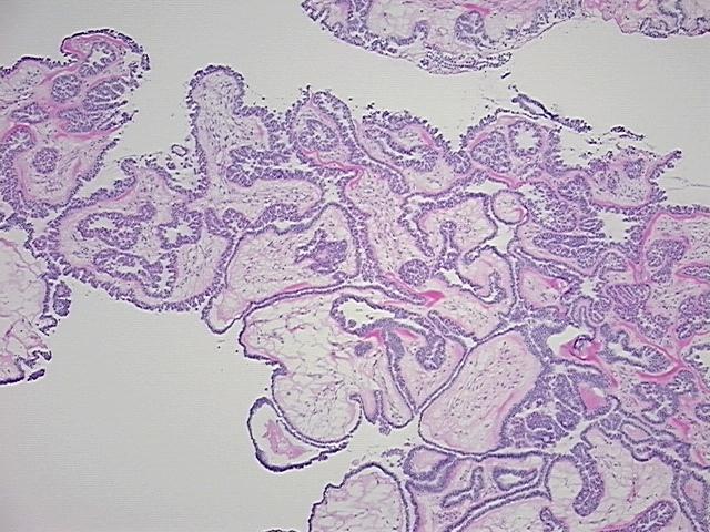 4x Image