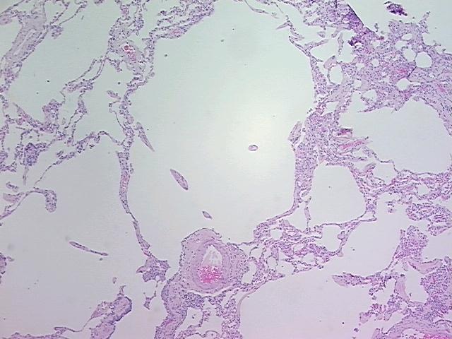 4x Image