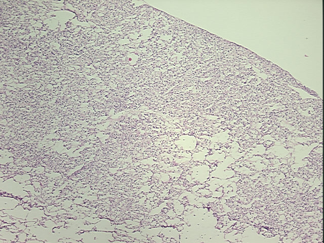 4x Image