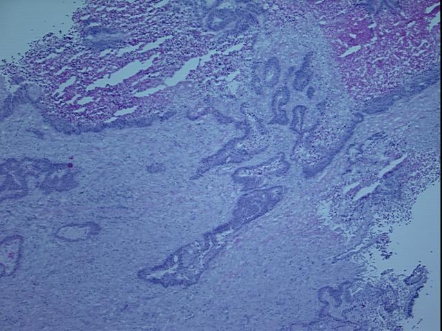 4x Image