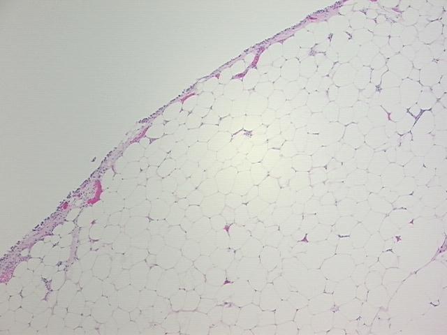 4x Image