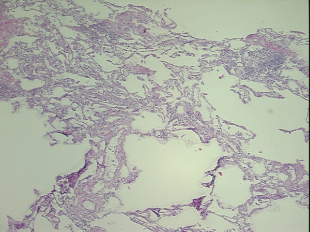 4x Image