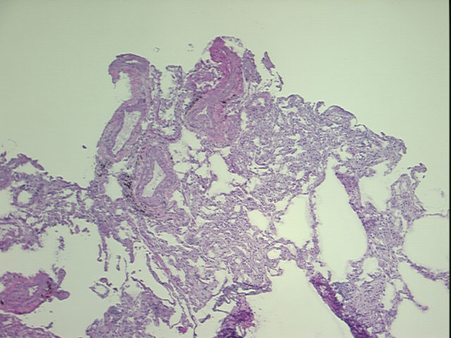 4x Image