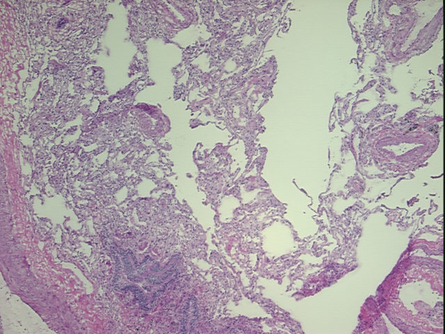 4x Image