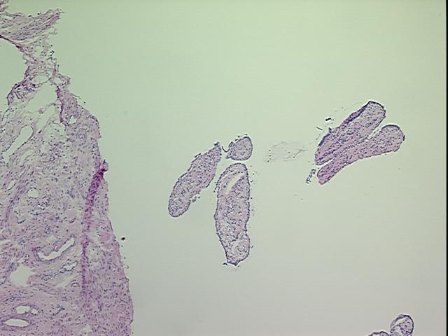 4x Image