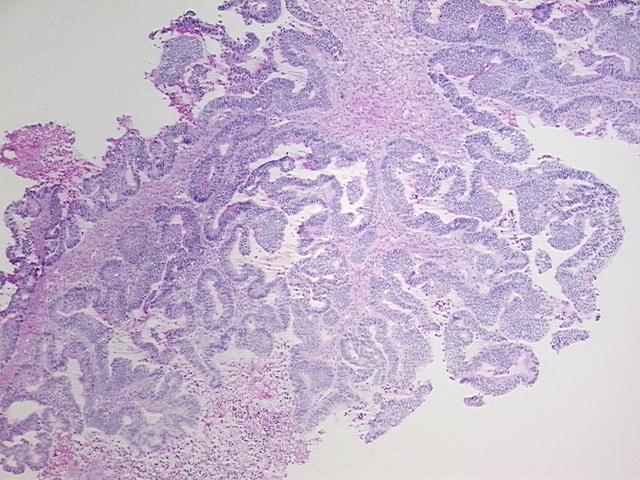 4x Image