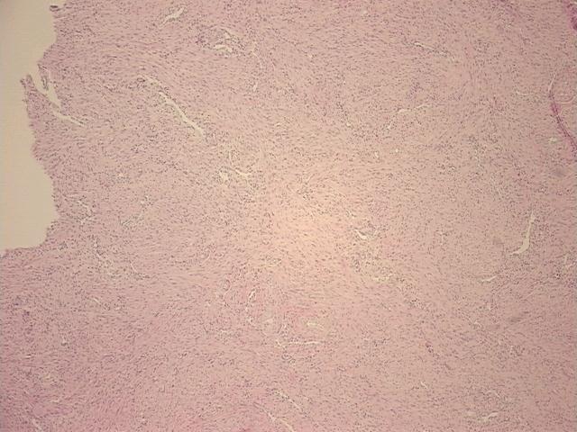 4x Image