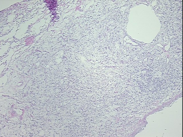 4x Image