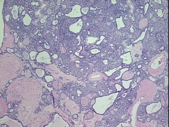 4x Image