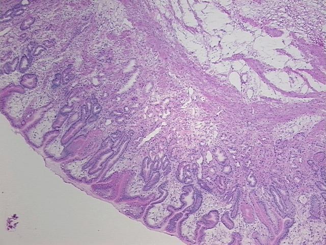 4x Image