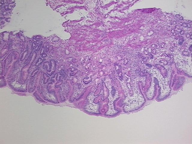 4x Image