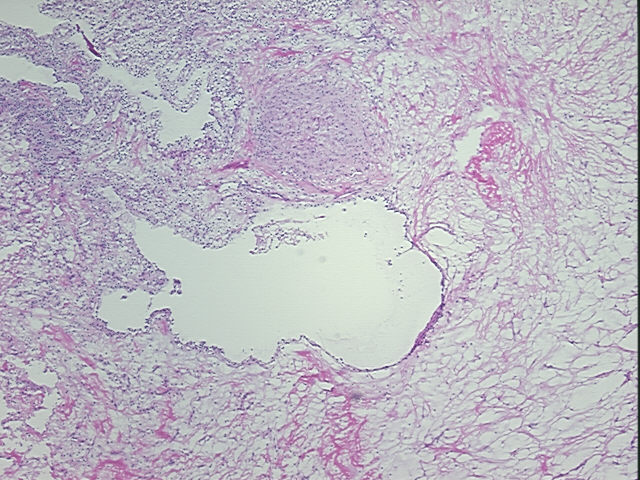 4x Image
