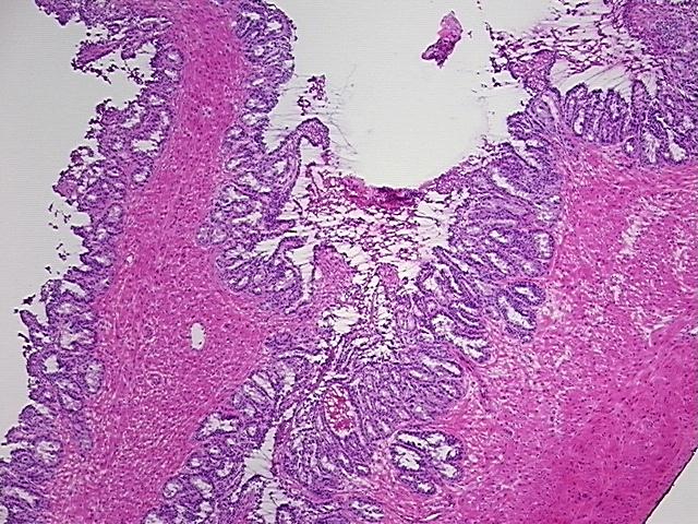 4x Image