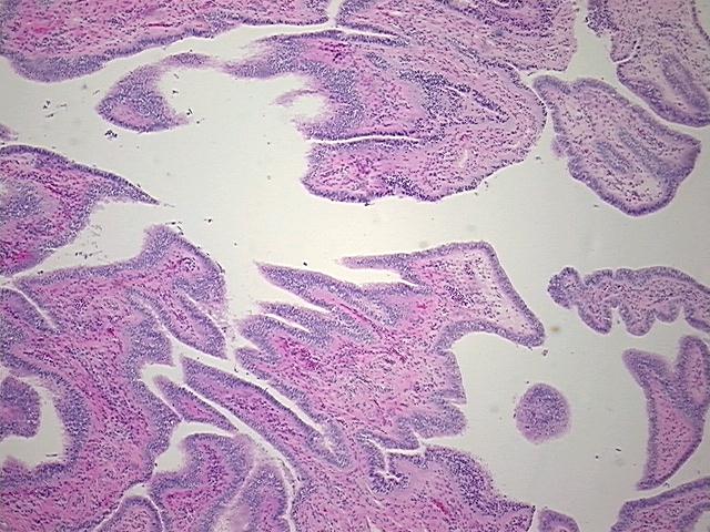 4x Image