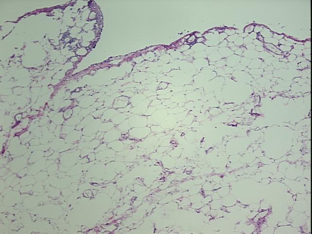 Frozen Tissue Sections, Omentum | CS601085 | OriGene Technologies Inc.