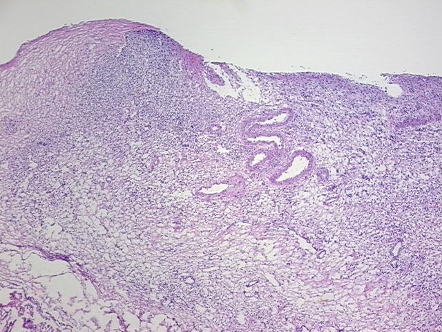4x Image