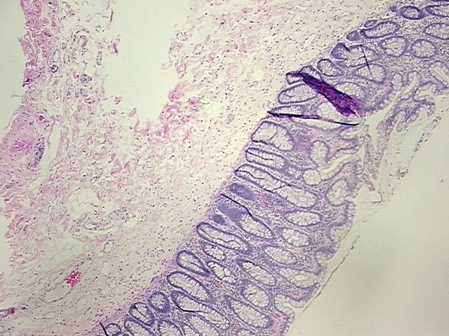 4x Image
