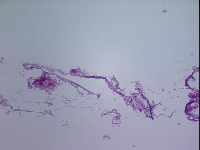 4x Image