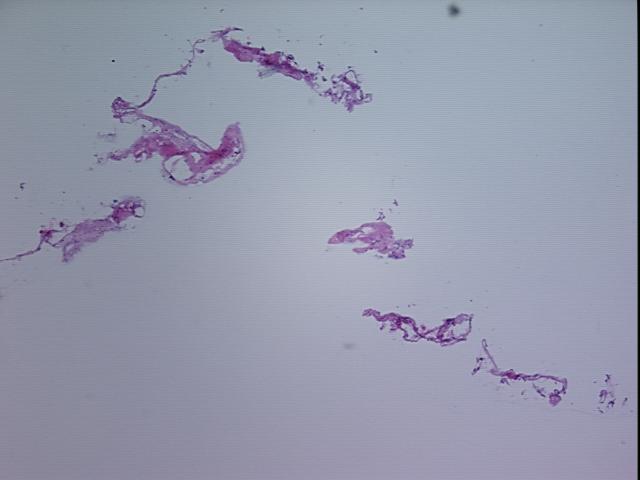 4x Image