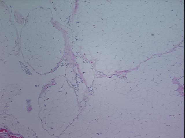 4x Image